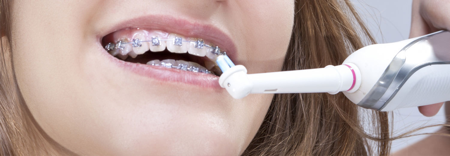 electric toothbrush with braces